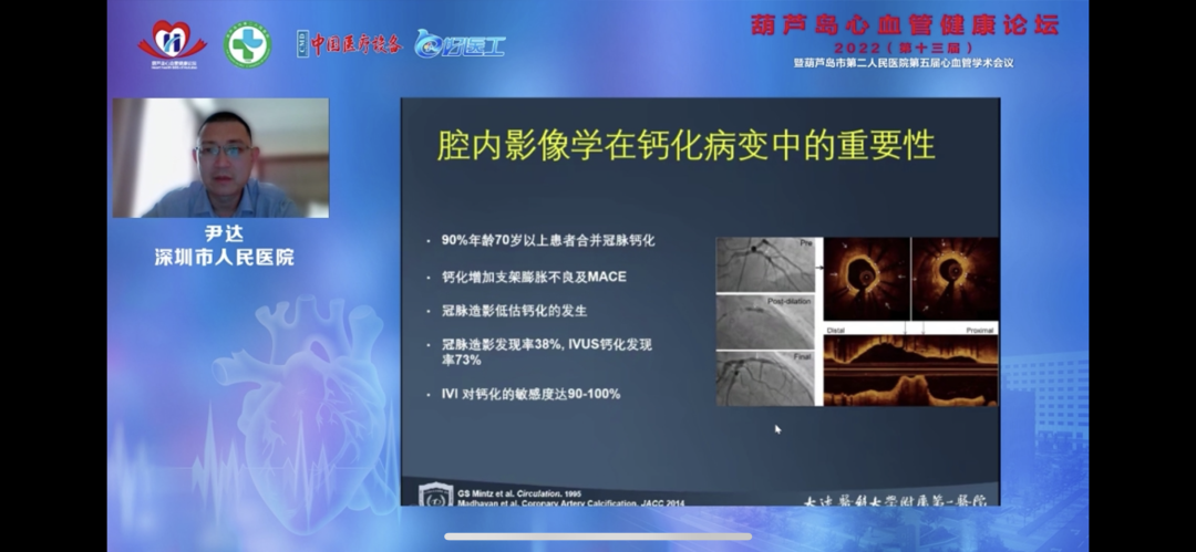 葫蘆島心血管健康論壇?2022｜創(chuàng)新驅(qū)動(dòng)發(fā)展，不斷提升心血管疾病救治能力(圖11)